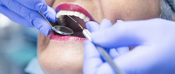 Best Emergency Tooth Extraction  in Tuscola, IL